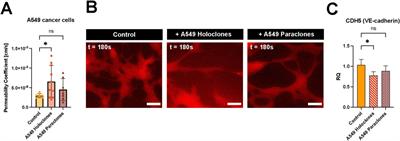 Assessing the metastatic potential of circulating tumor cells using an organ-on-chip model